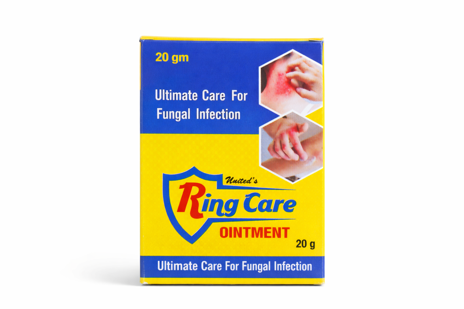 Ring Care Ointment 20gm